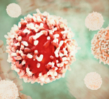 מחלת הסרטן והקשר לדלקת-תמונה